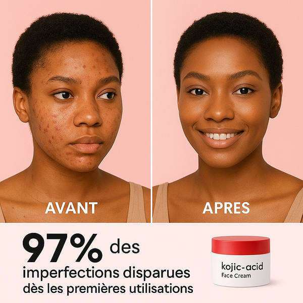 Kojic Glow – Crème visage complète : anti-taches, anti-acné, anti-âge . L’original qualité