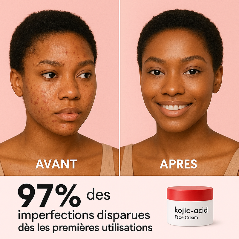 Kojic Glow – Crème visage complète : anti-taches, anti-acné, anti-âge . L’original qualité